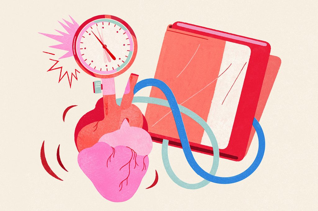 Régime Keto et Hypertension Artérielle : Avis de la science