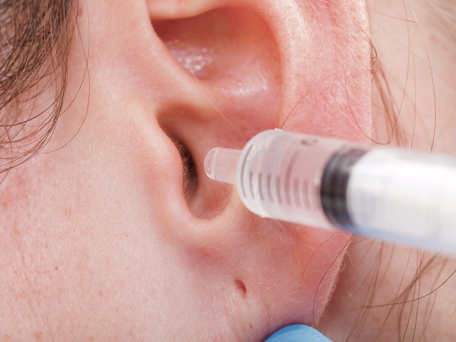 Bouchon de cérumen traitement : Comment le médecin enlève un bouchon de cire dans l'oreille ?